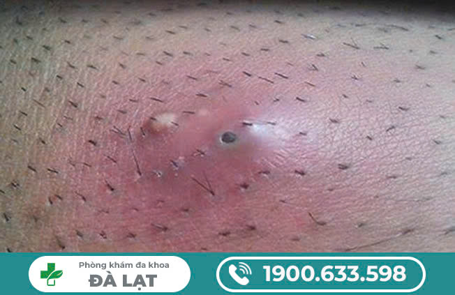 Hình ảnh minh họa